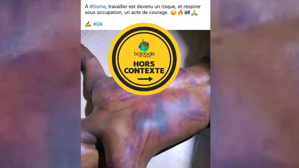 Cette photo ne montre pas un homme torturé à Goma en RDC, elle a été prise en Libye